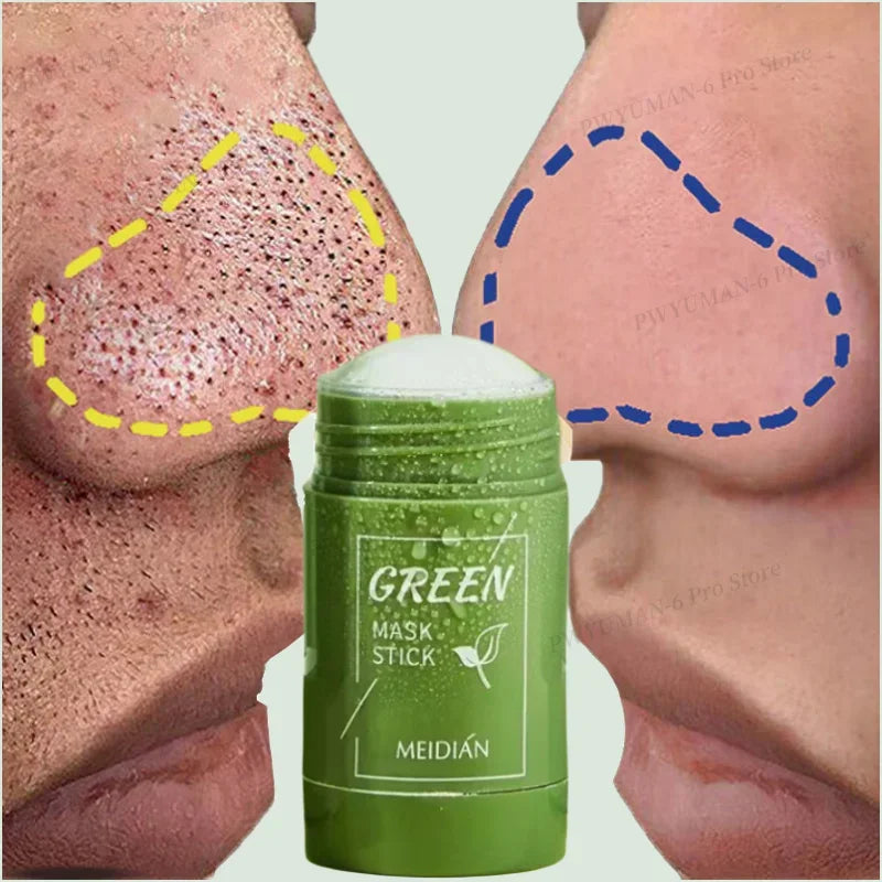 Máscara de Chá Verde Removedora de Cravos,Acne e Poros - GreenMask™