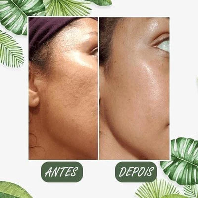 Máscara de Chá Verde Removedora de Cravos,Acne e Poros - GreenMask™