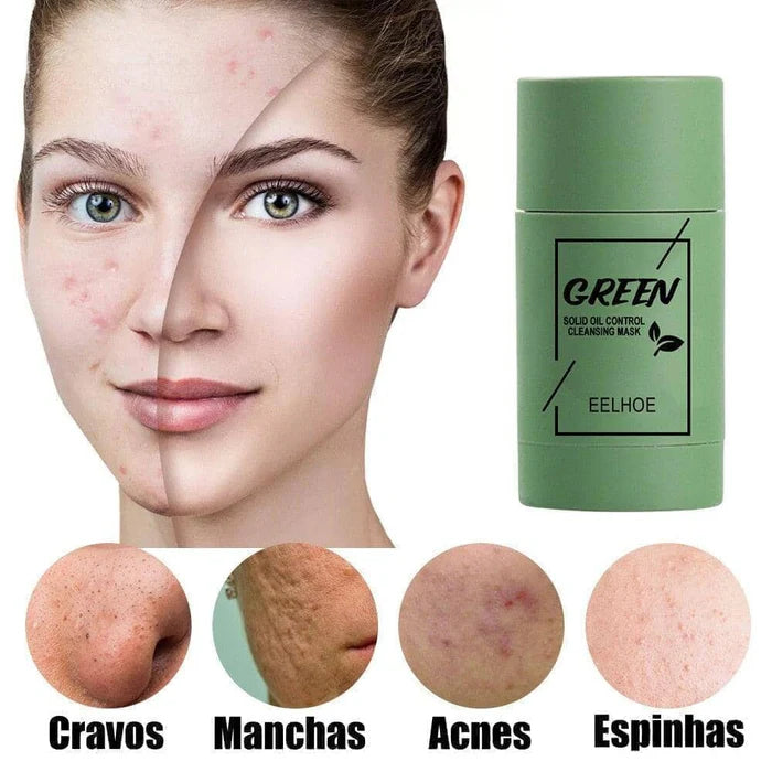 Máscara de Chá Verde Removedora de Cravos,Acne e Poros - GreenMask™